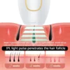 IPL Laser Epilator For Women Flash Depilator Pulse Permanent Laser Epilator Home Use Epilator - Image 4